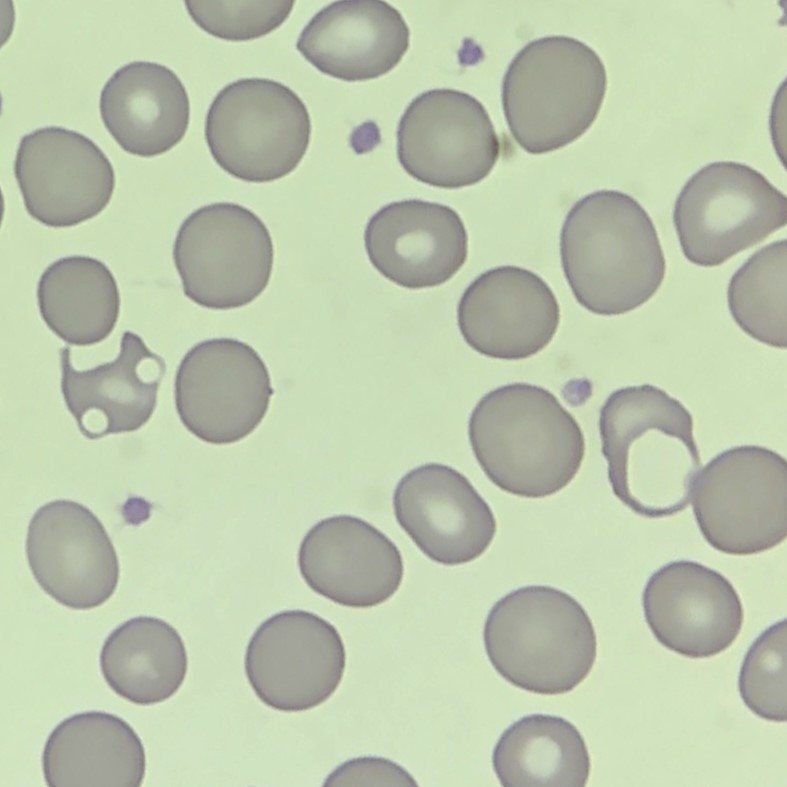 Blister Cells