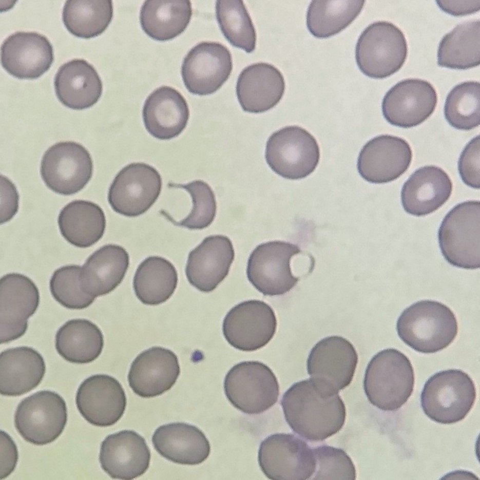 Blister Cells