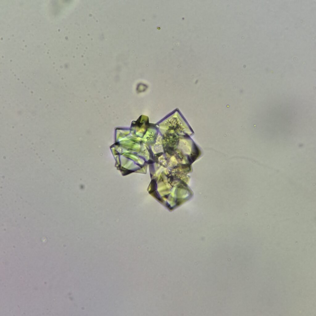 Calcium Oxalate Crystals (Dihydrate)