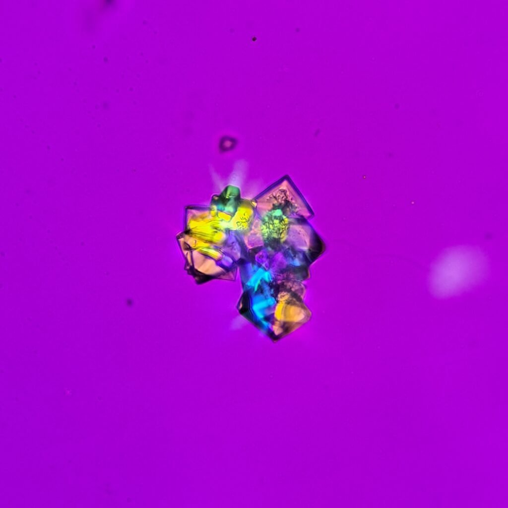 Calcium Oxalate Crystals (Dihydrate), Polarized)