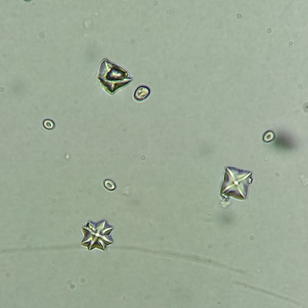 Calcium Oxalate Crystals (Dihydrate)