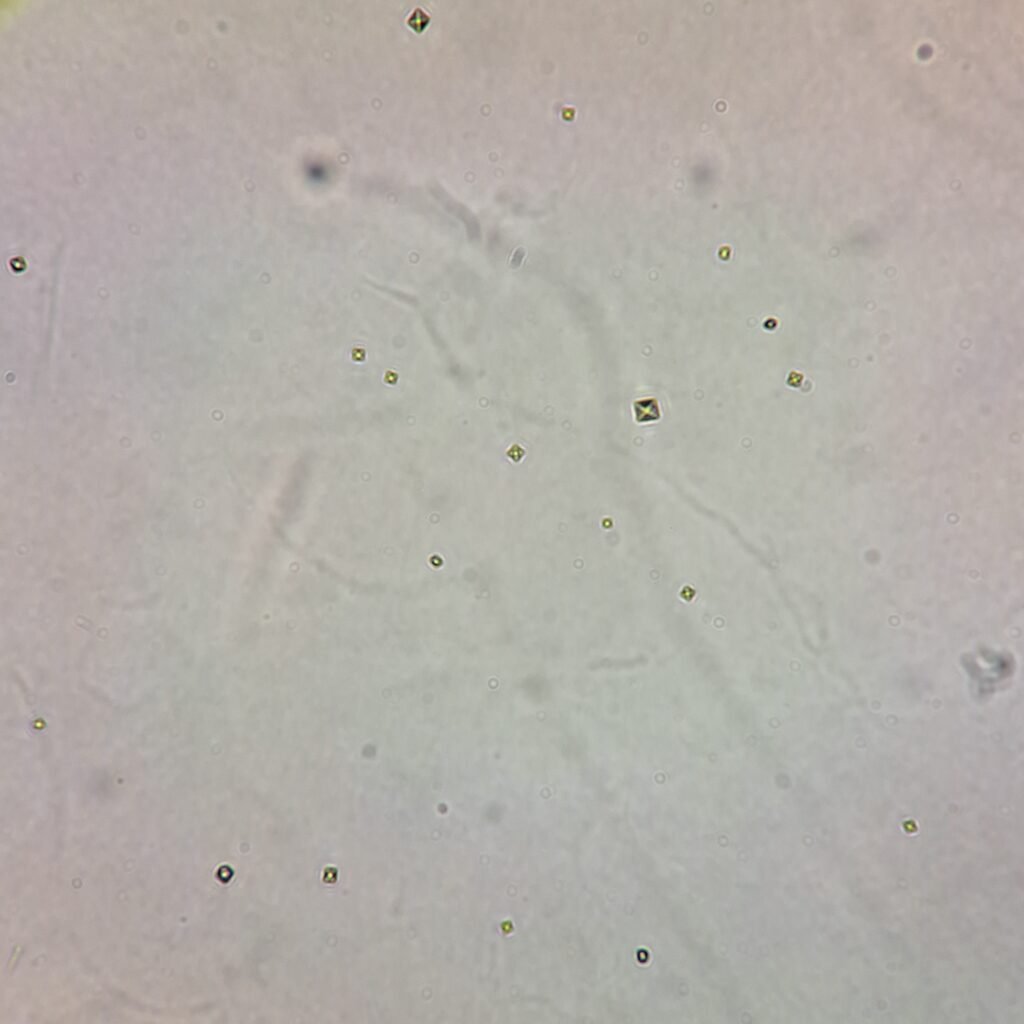 few calcium oxalate crystals