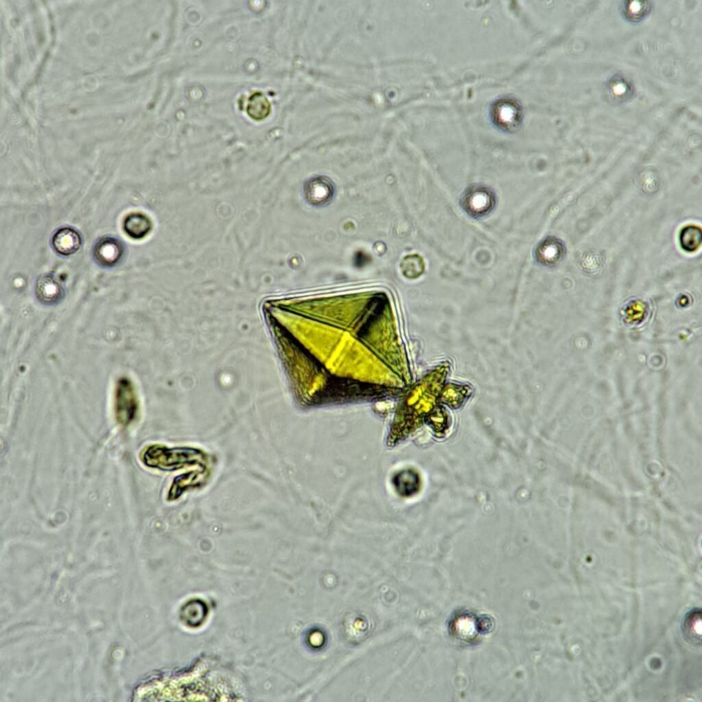 Calcium Oxalate Crystals (Dihydrate)