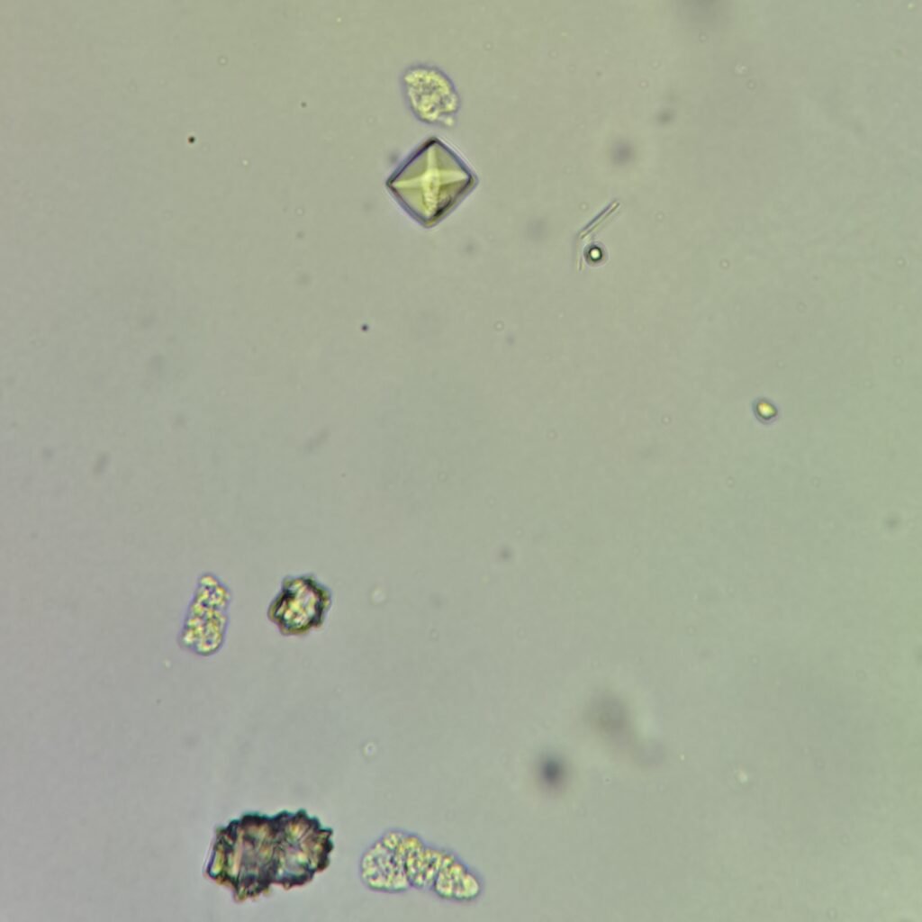 Calcium Oxalate Crystals (Dihydrate)