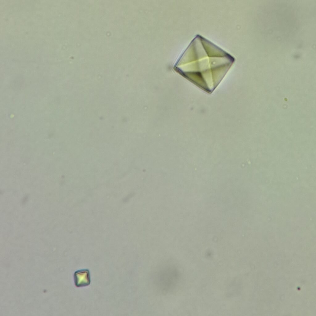 Calcium Oxalate Crystals (Dihydrate)
