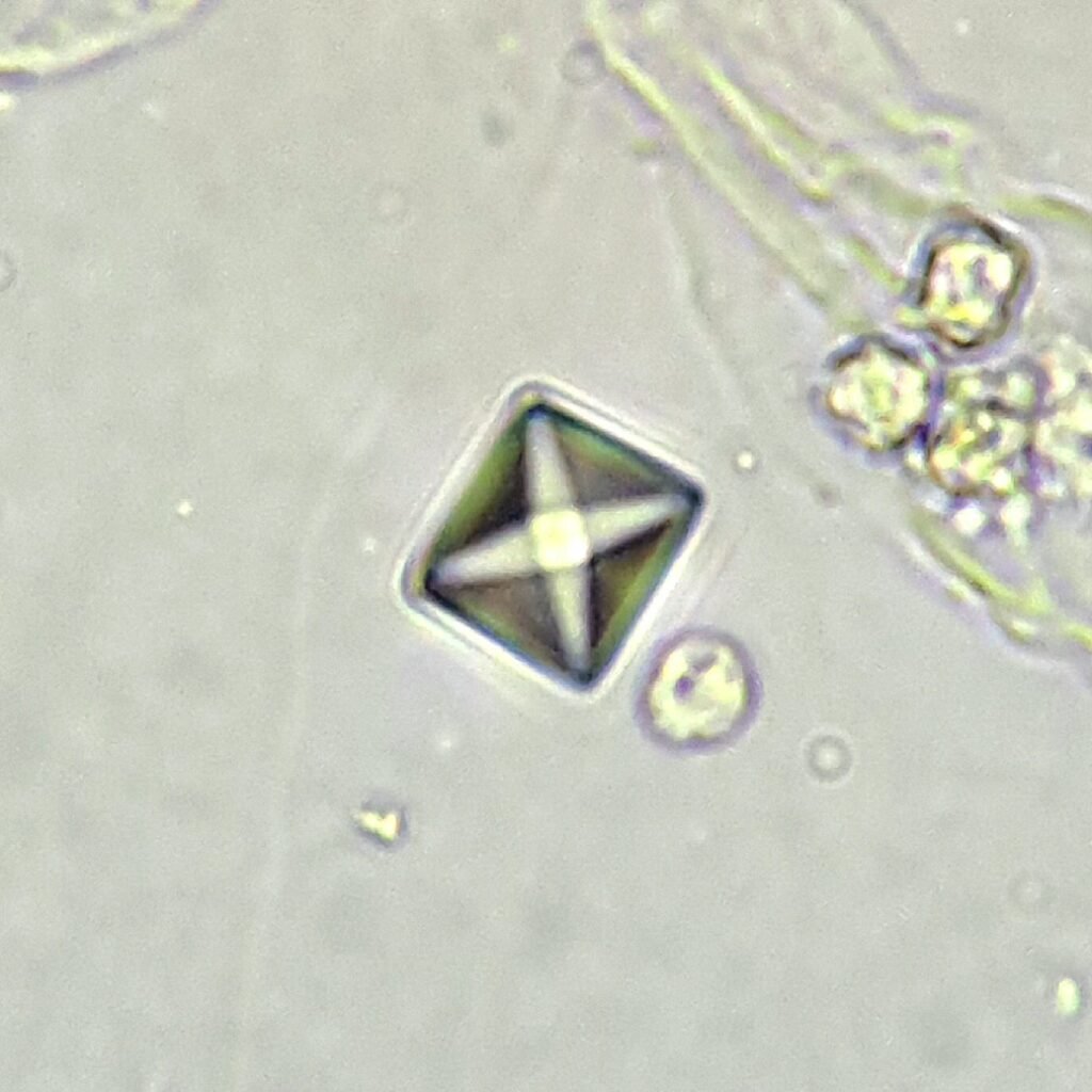 Calcium Oxalate Crystal (Dihydrate)