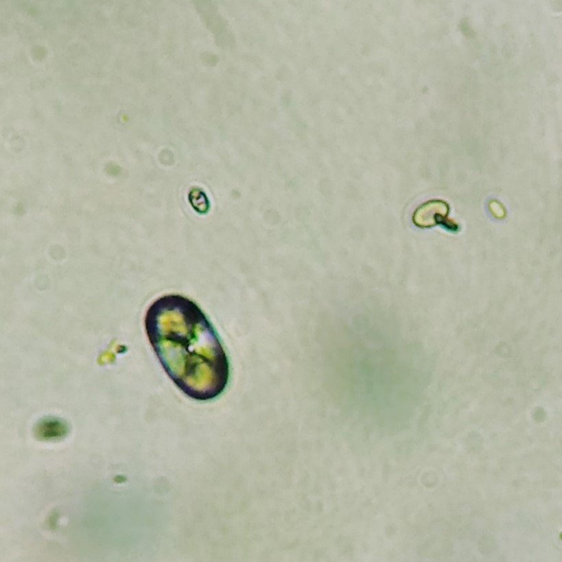 Calcium Oxalate Crystals (Monohydrate)