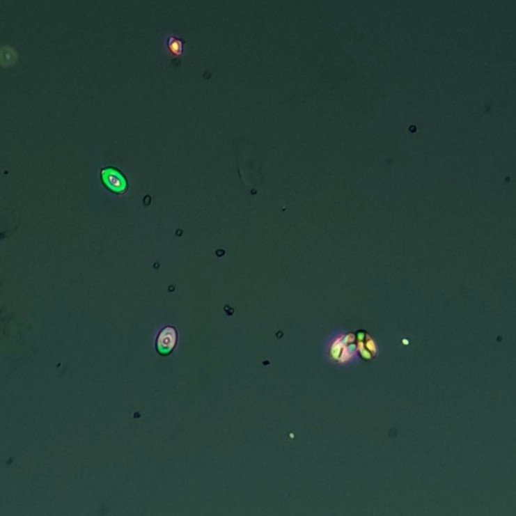 Calcium Oxalate Crystals (Monohydrate), Polarized