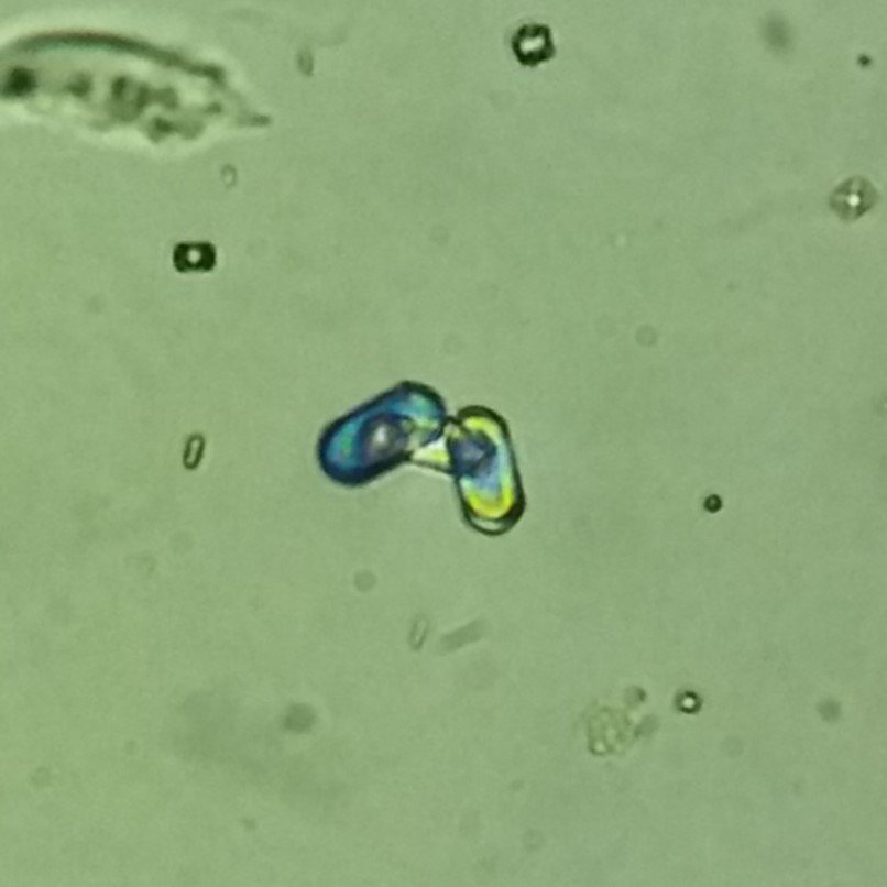 Calcium Oxalate Crystals (Monohydrate), Polarized