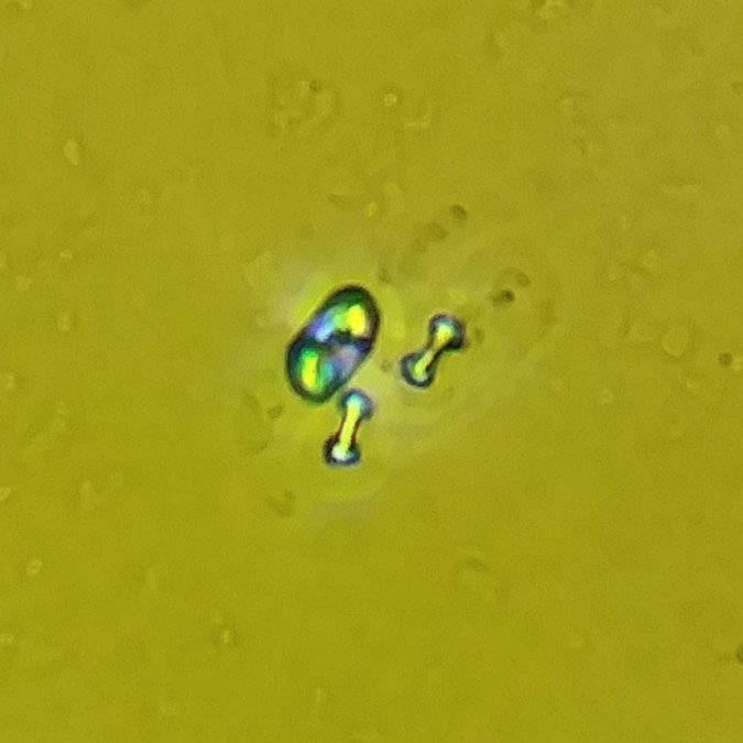 Calcium Oxalate Crystals (Monohydrate), Polarized