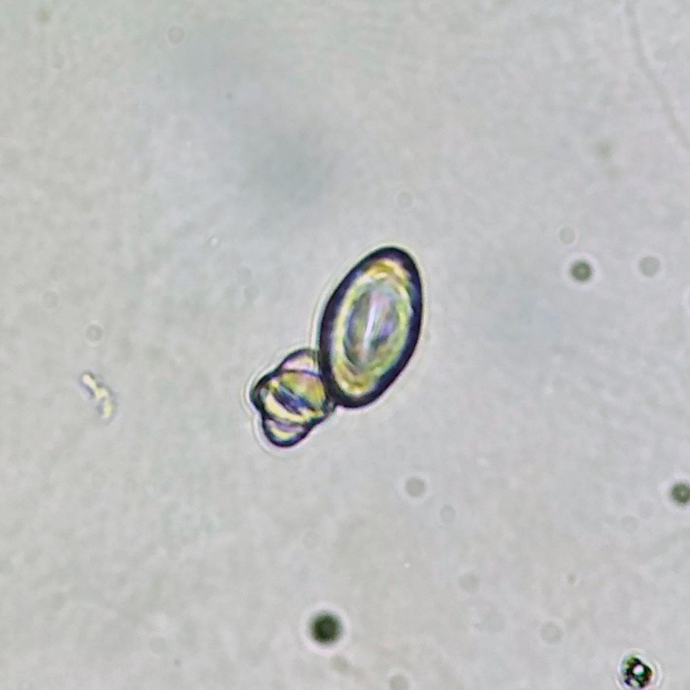 Calcium Oxalate Crystals (Monohydrate)