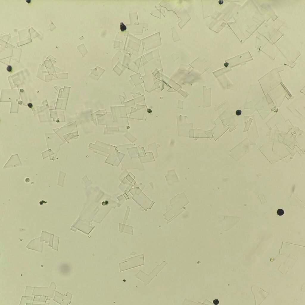 Cholesterol crystals in body fluid