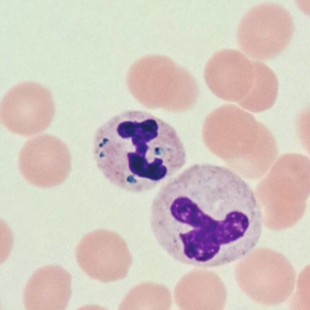 Critical Green Inclusion in Neutrophil. AKA "Green Crystals of Death"