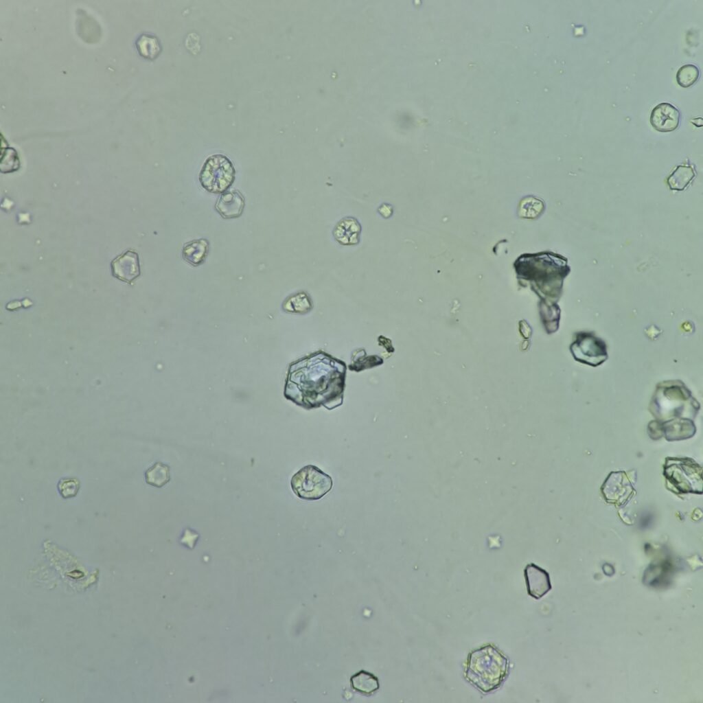 Cystine Crystals