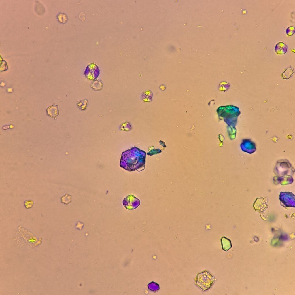 Cystine Crystals, Polarized