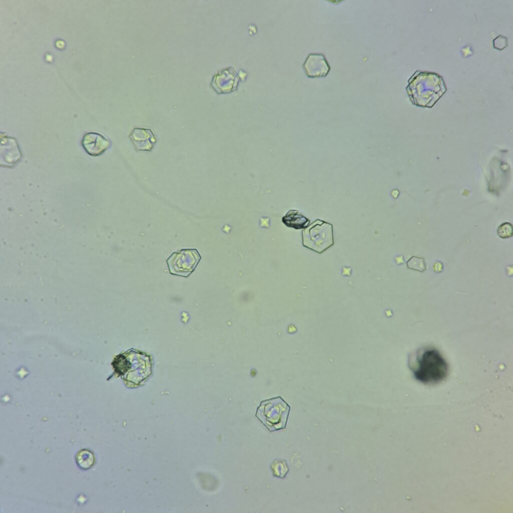 Cystine Crystals