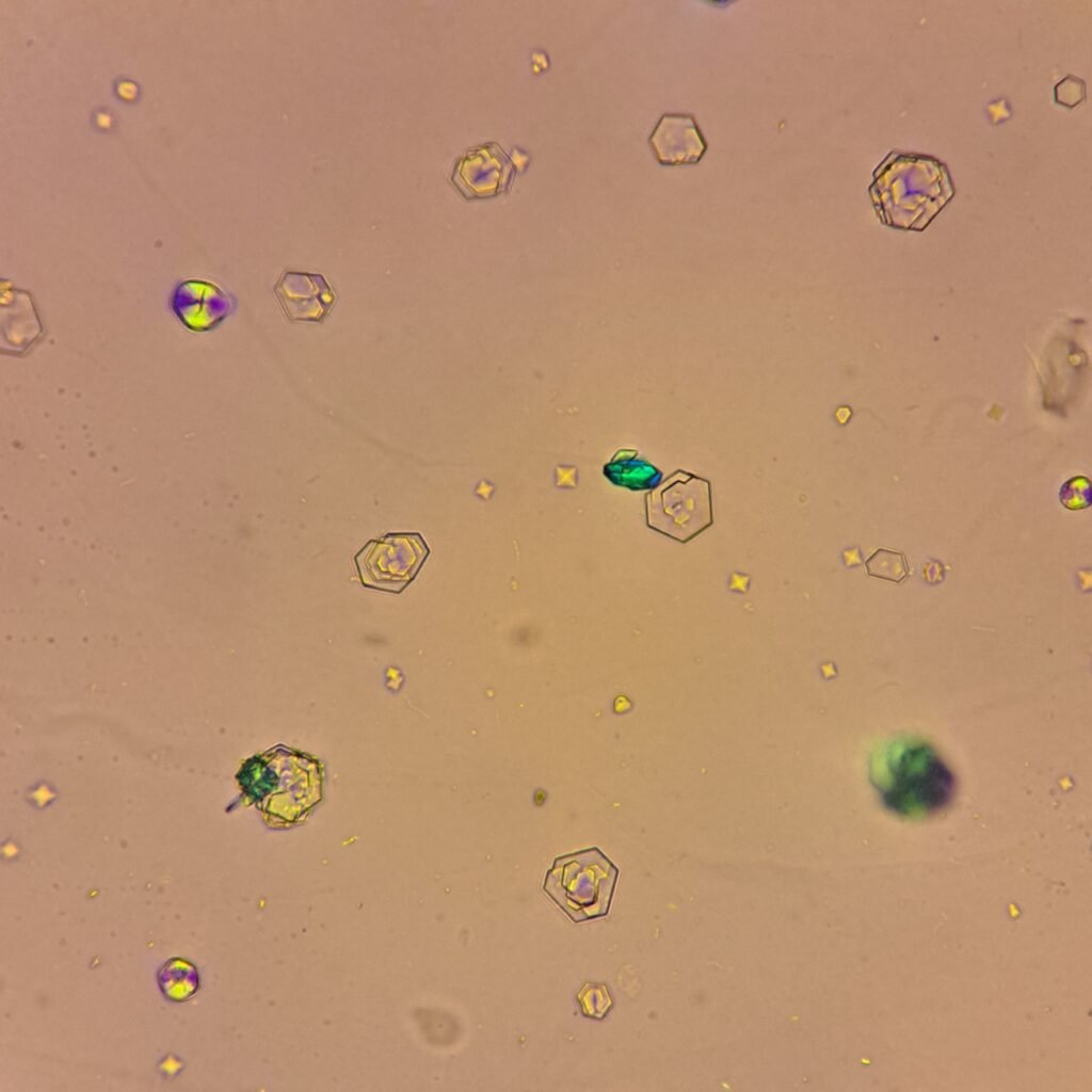 Cystine Crystals, Polarized