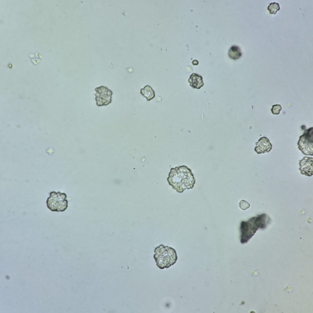 Cystine Crystals