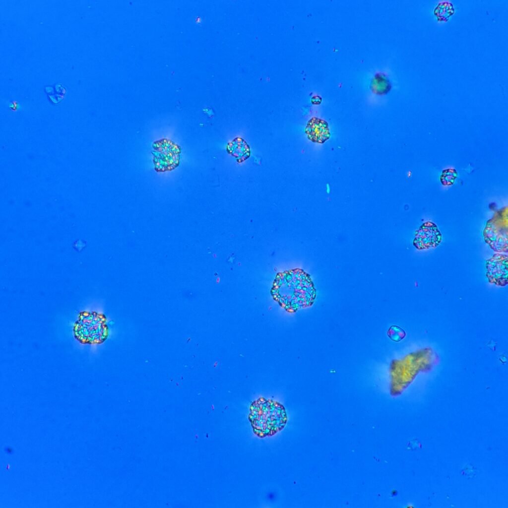 Cystine Crystals, Polarized