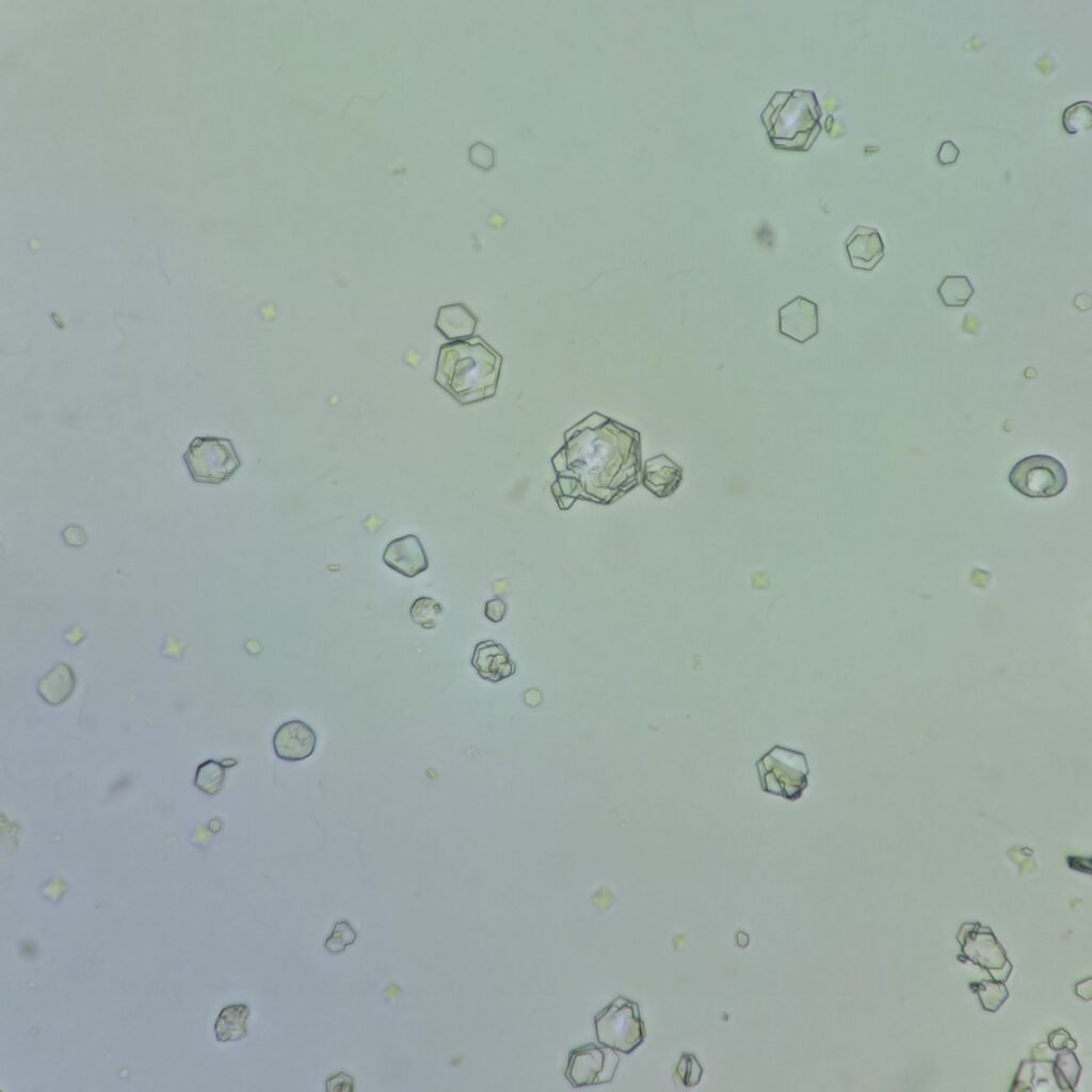Cystine Crystals
