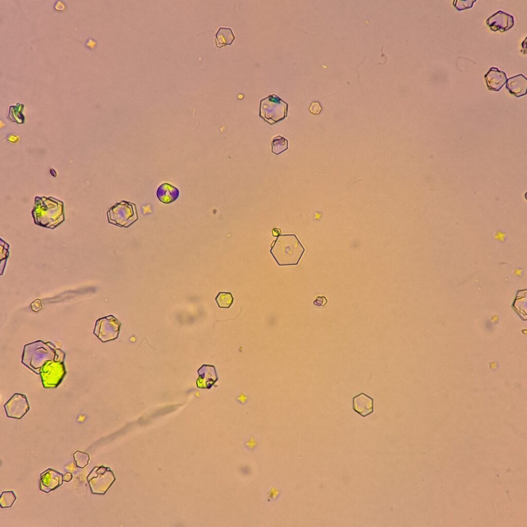 Cystine Crystals, Polarized
