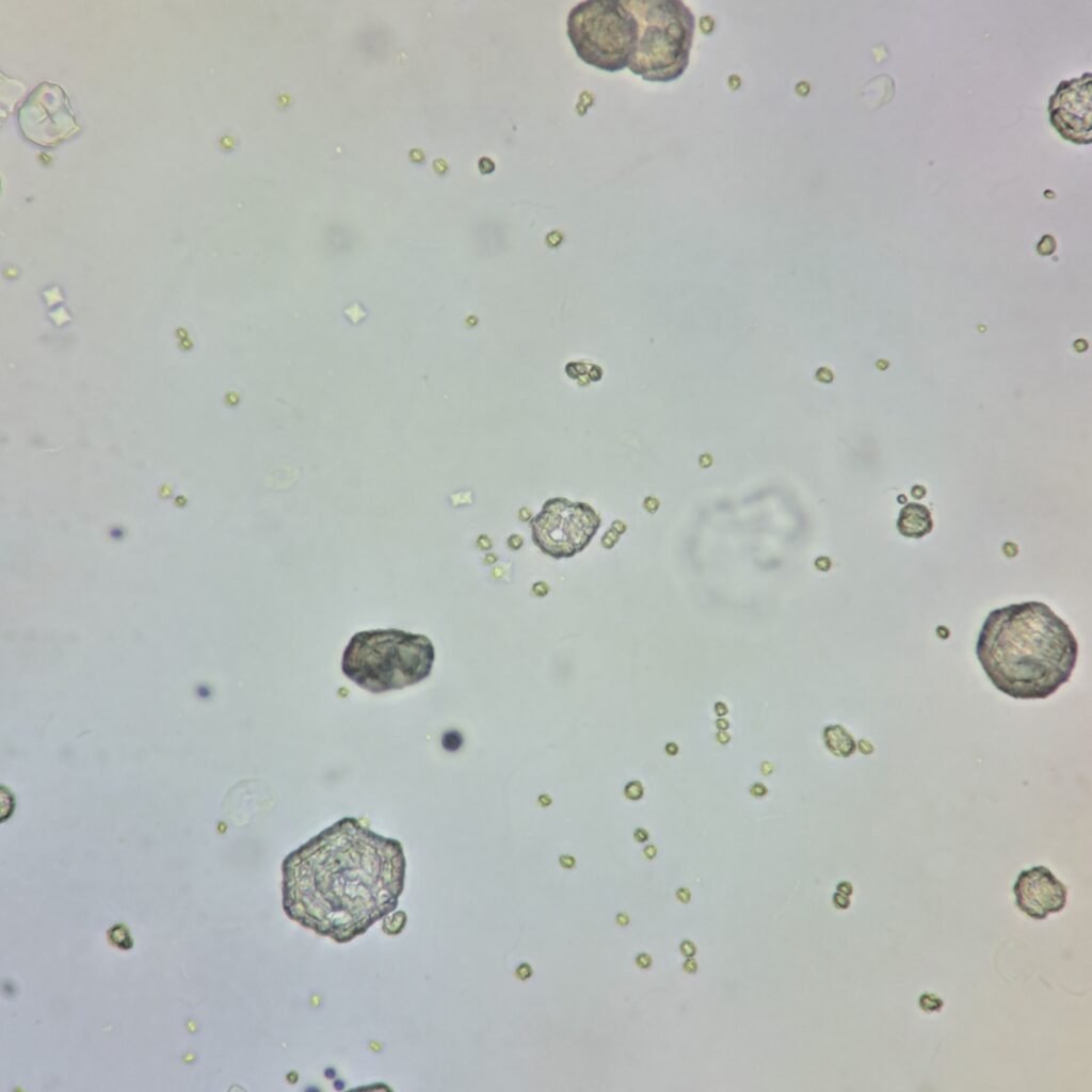 Cystine Crystals