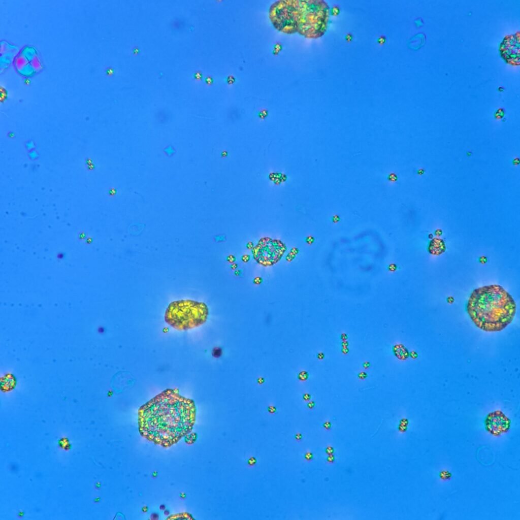 Cystine Crystals, Polarized