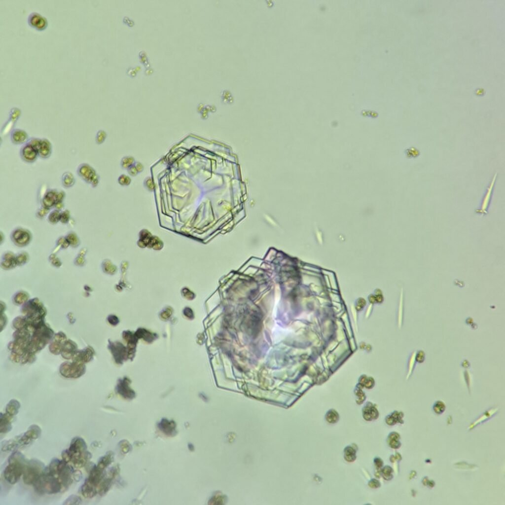 Cystine Crystals