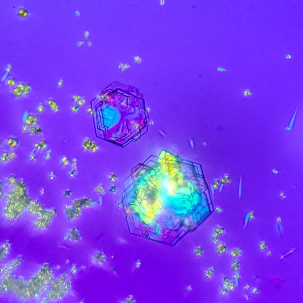 Cystine Crystals, Polarized