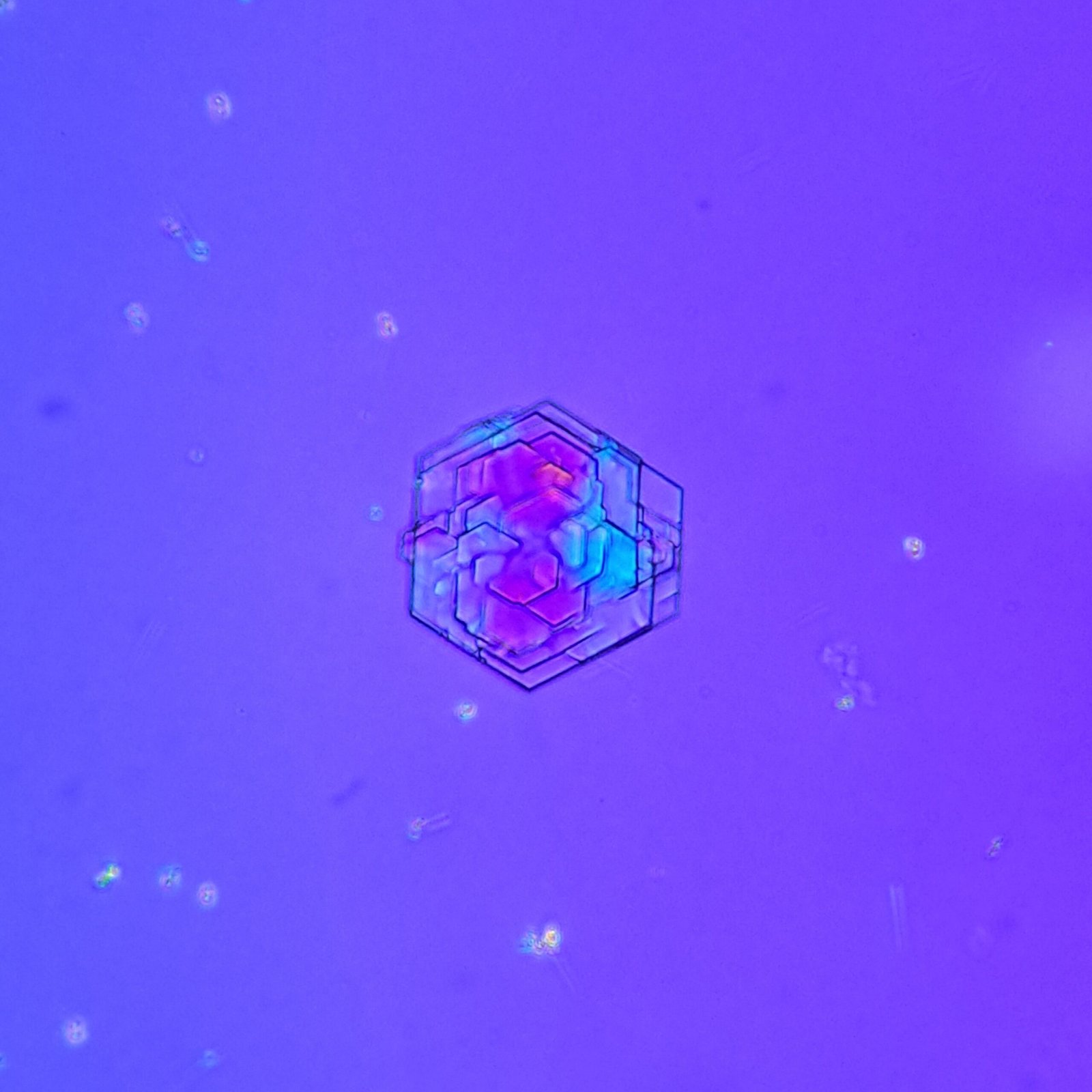 Cystine Crystals in urine sediment, Polarized