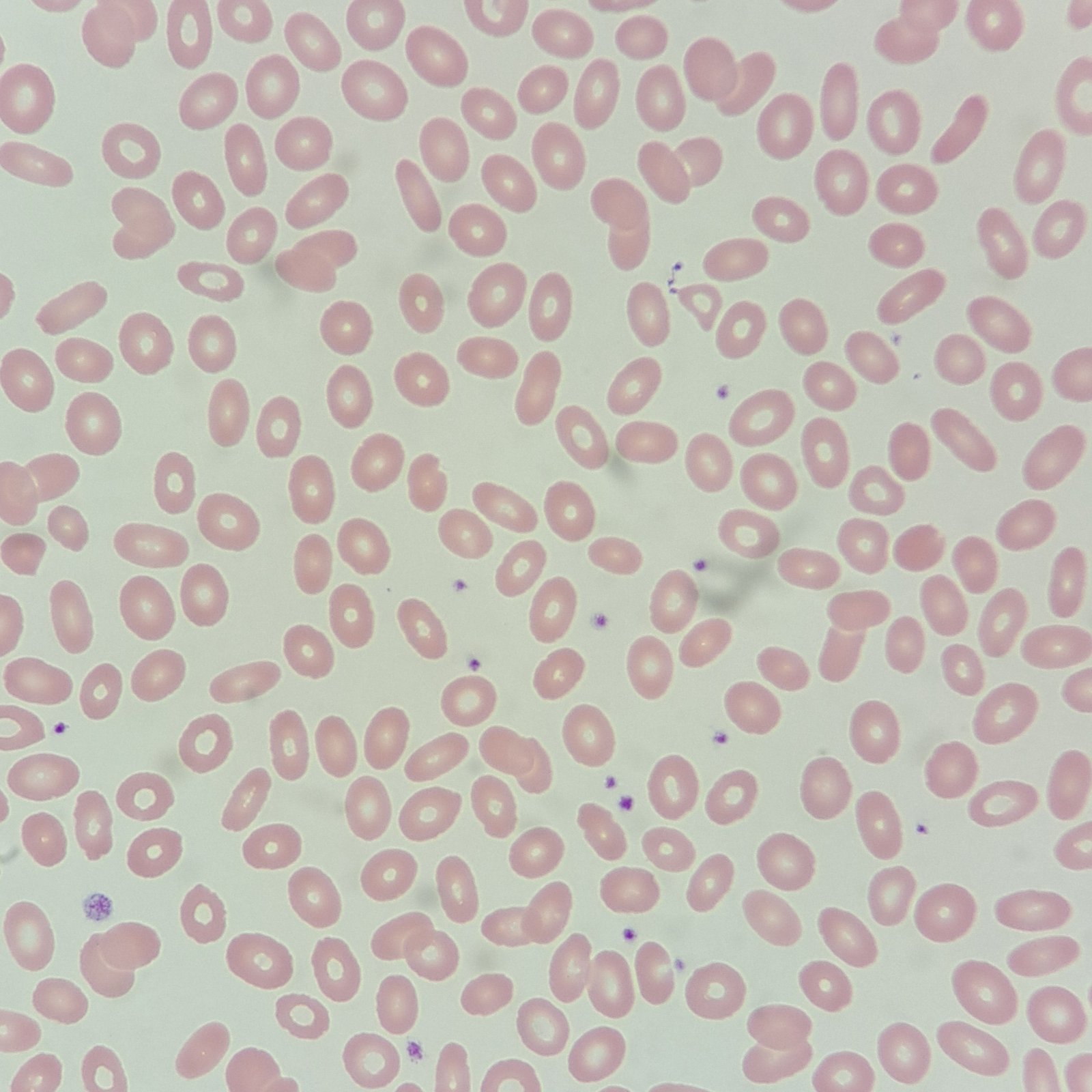 Elliptocytes / Ovalocytes