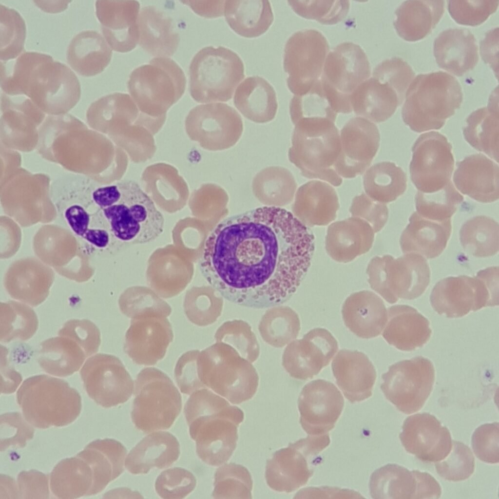 white blood cell: eosinophil