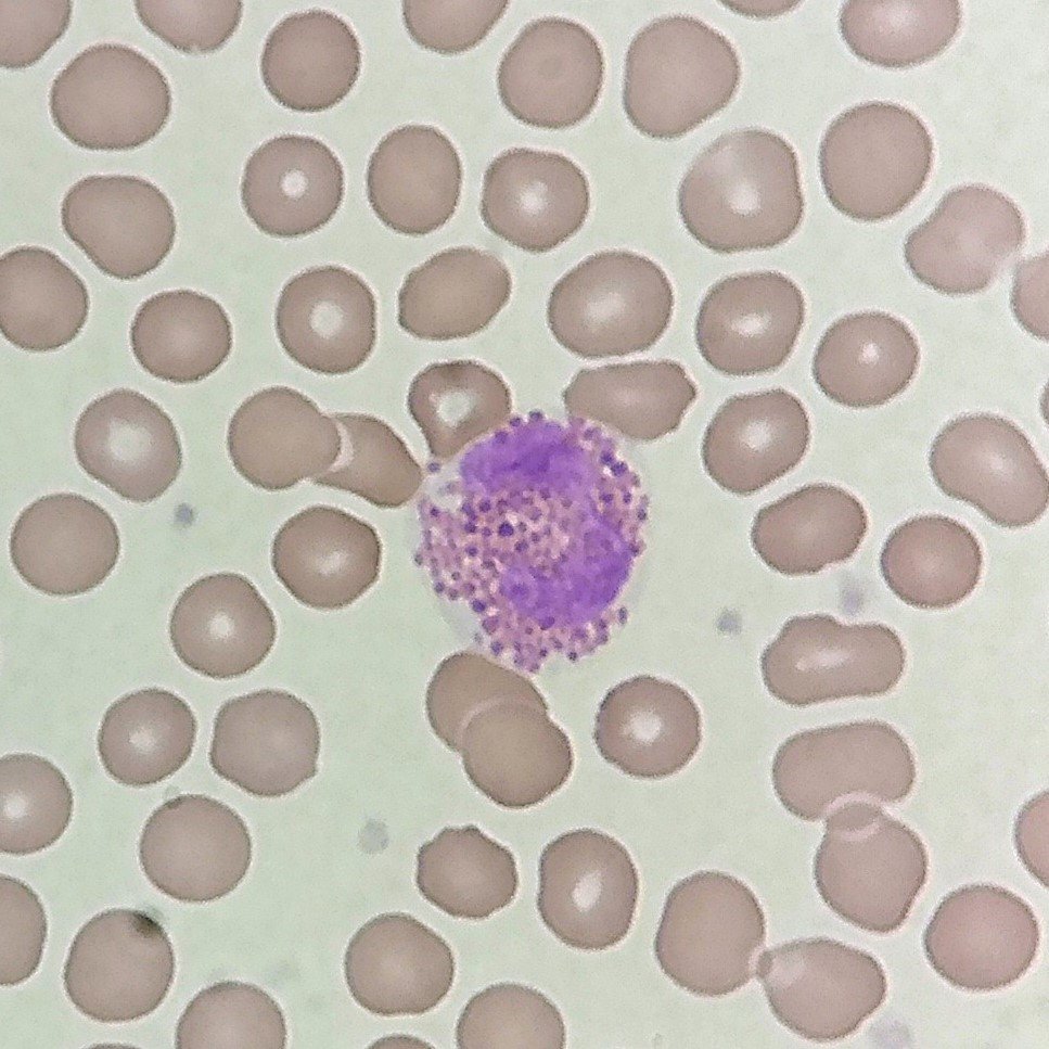 white blood cell: eosinophil