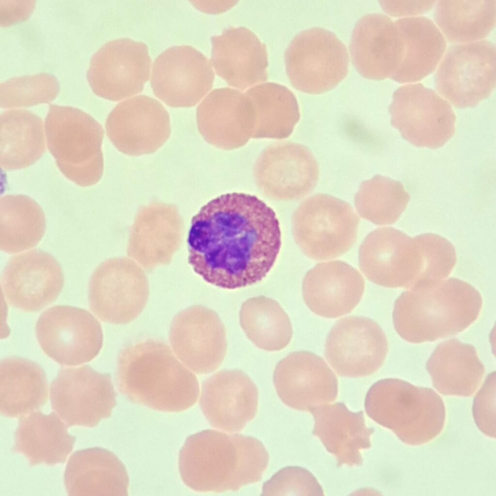 white blood cell: eosinophil