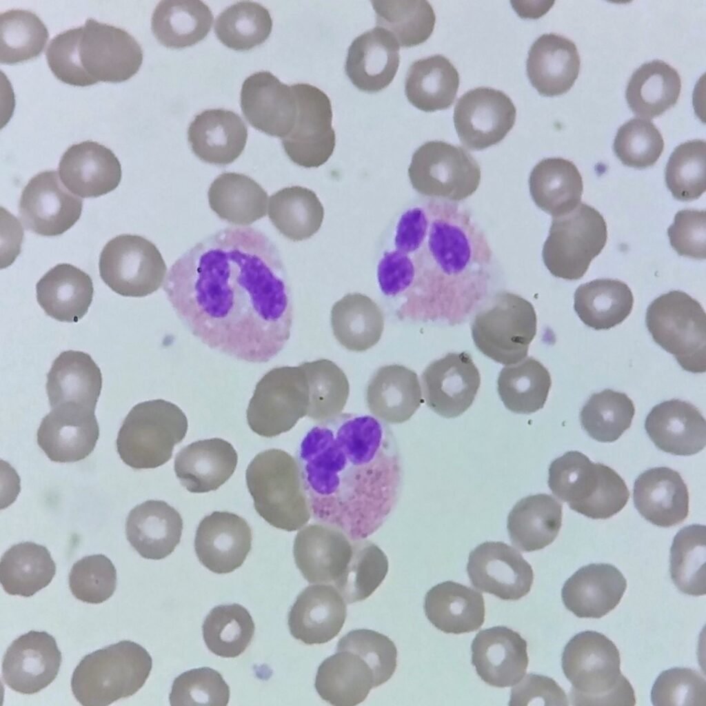 white blood cells: eosinophils