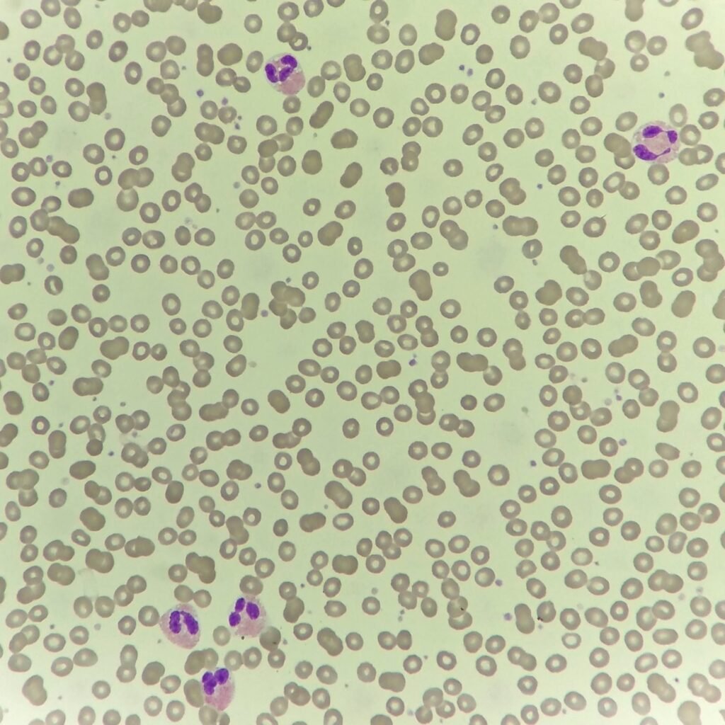 white blood cells: eosinophils