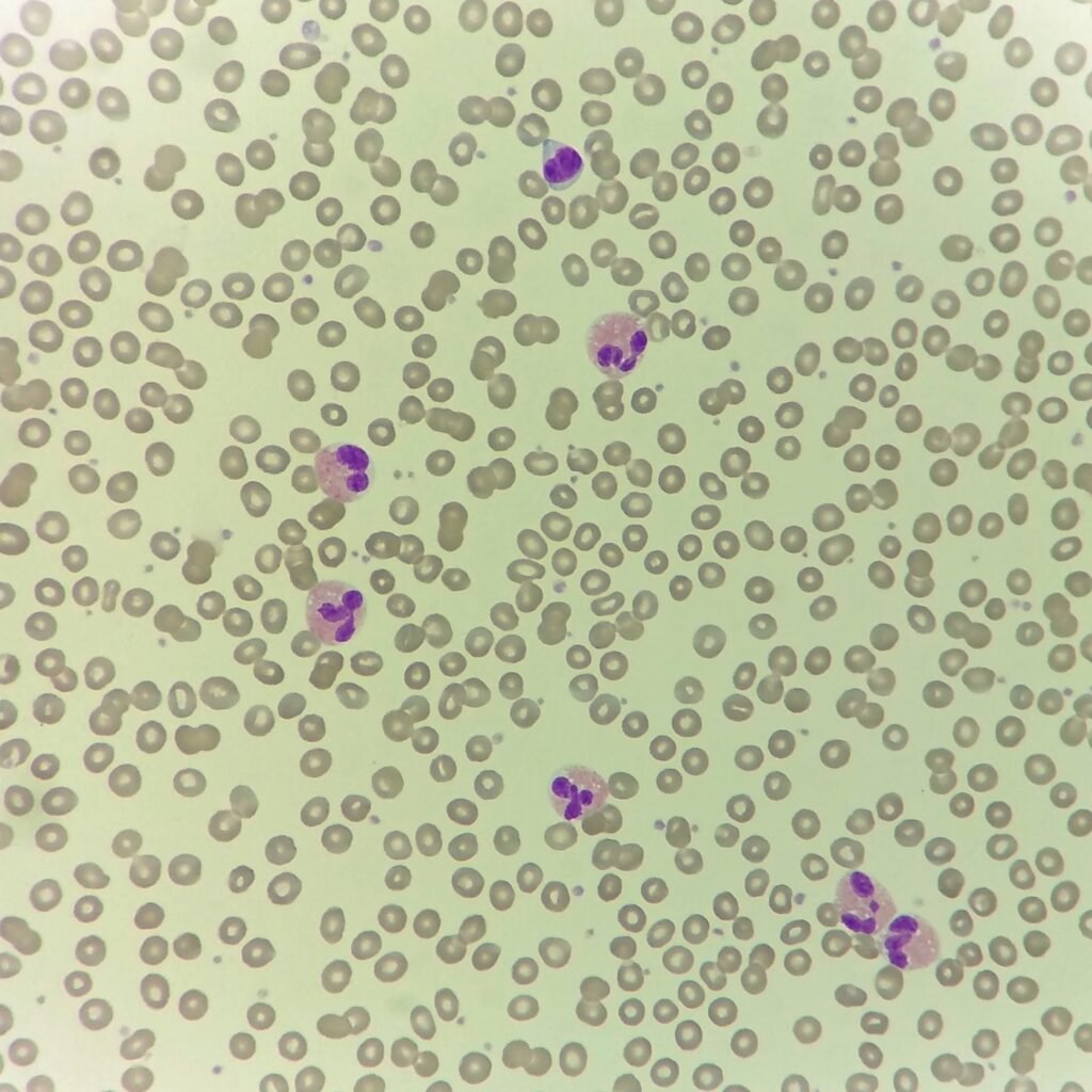 white blood cells: eosinophils