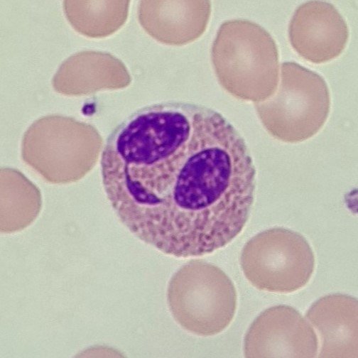 white blood cell: eosinophil