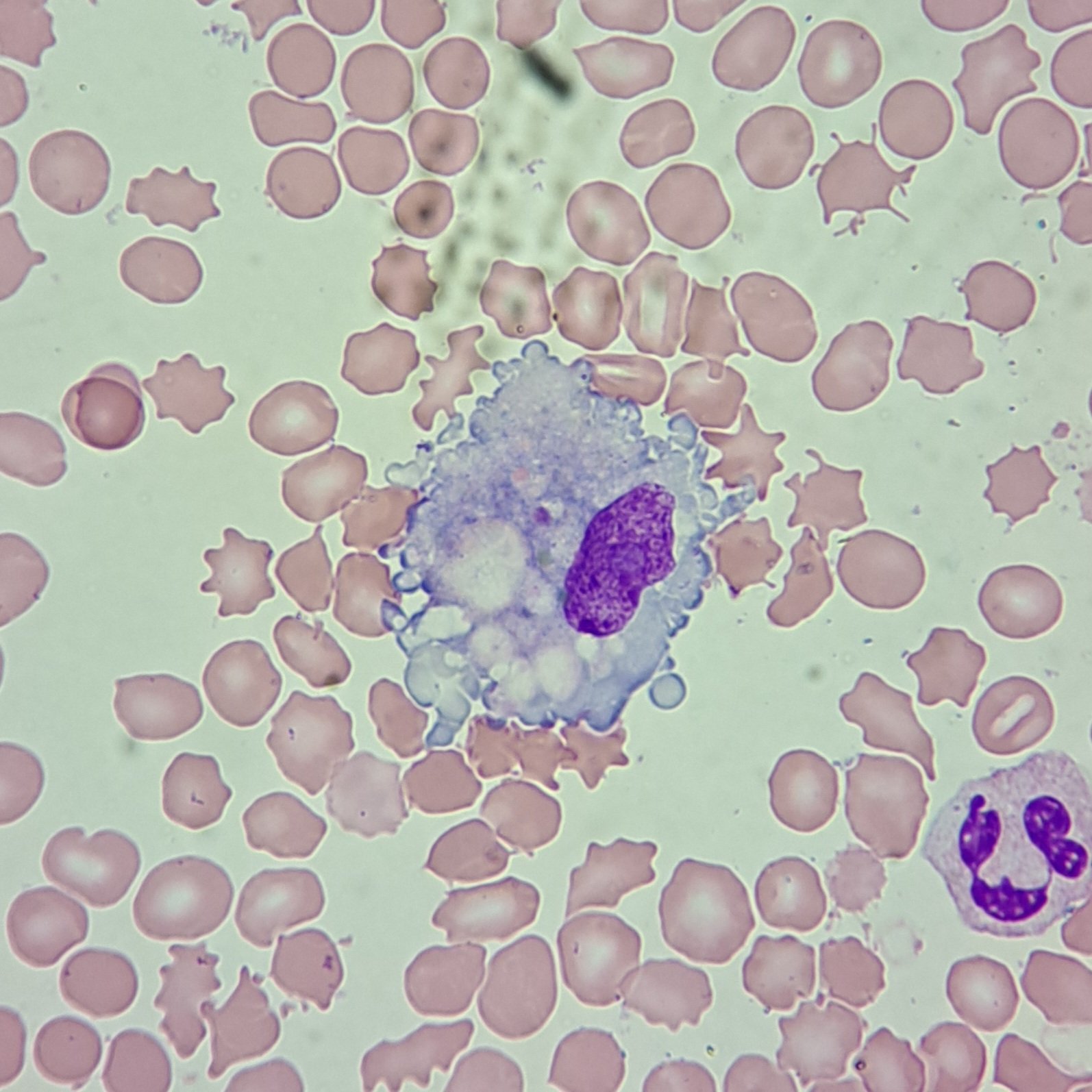 Monocyte Lab Model Body Fluid Monocytes / Macrophages - MedLabBuddy