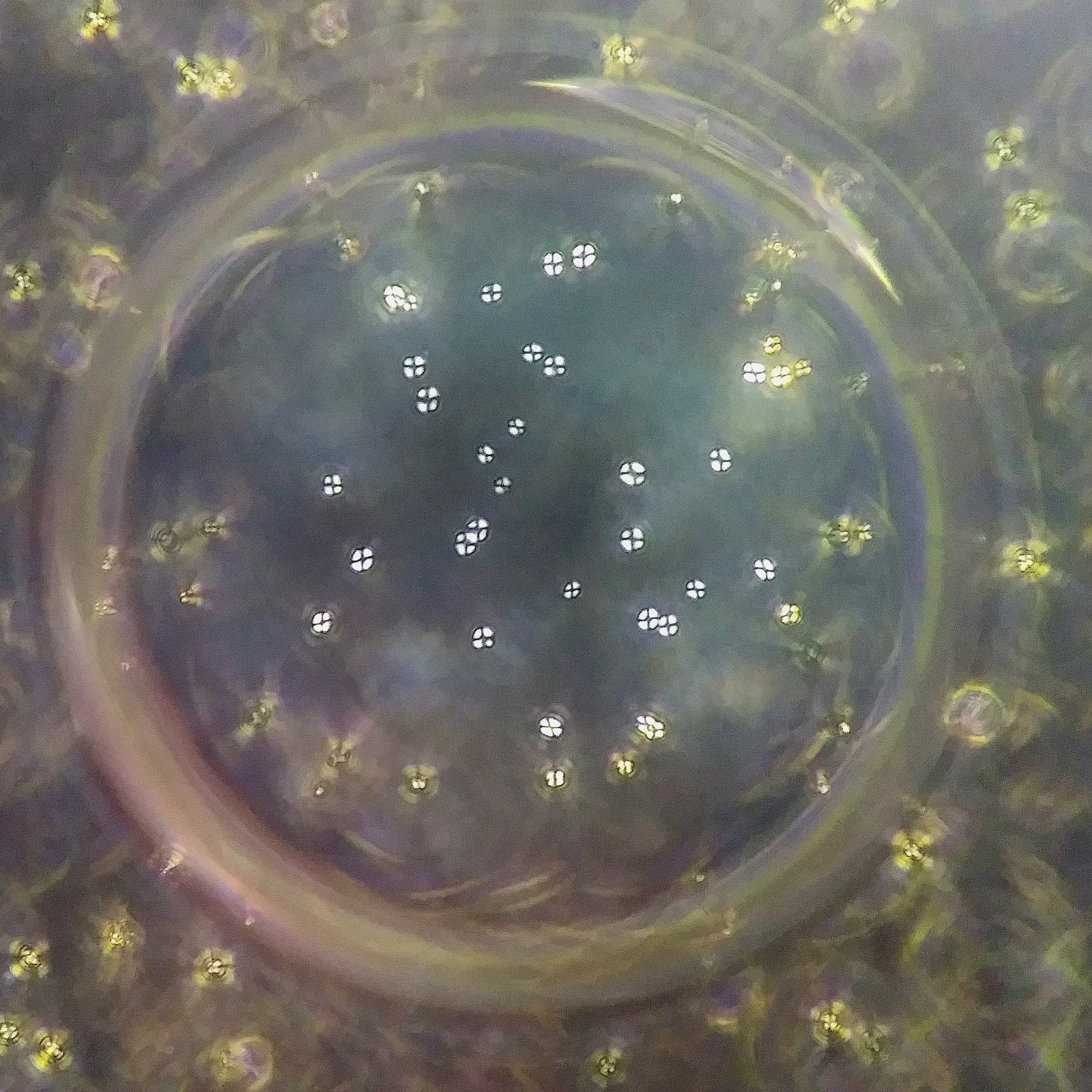 fat/lipid droplets in urine, polarized. Maltese crosses