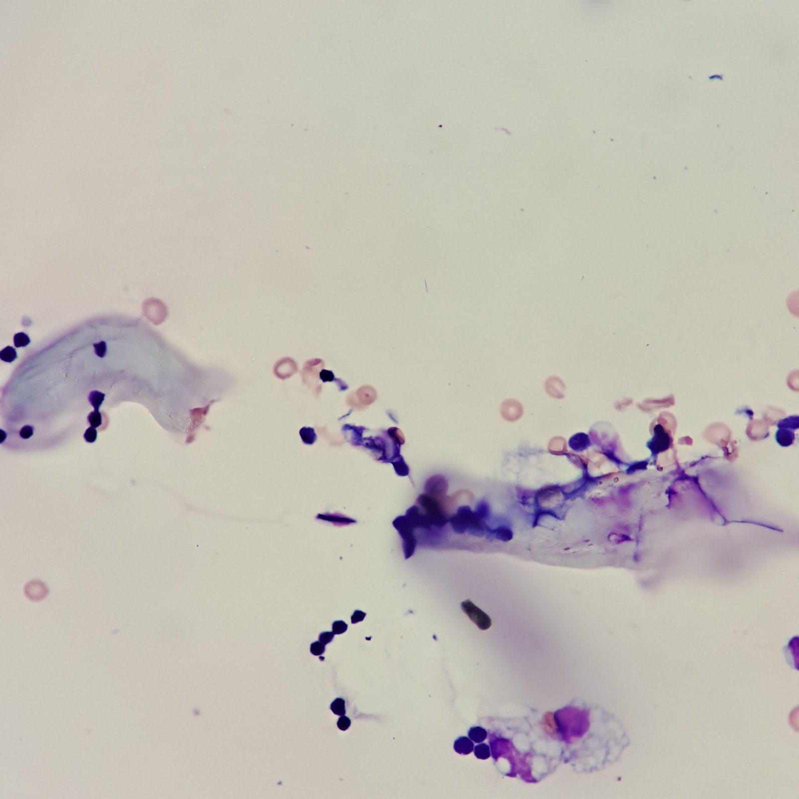 fiber in body fluid