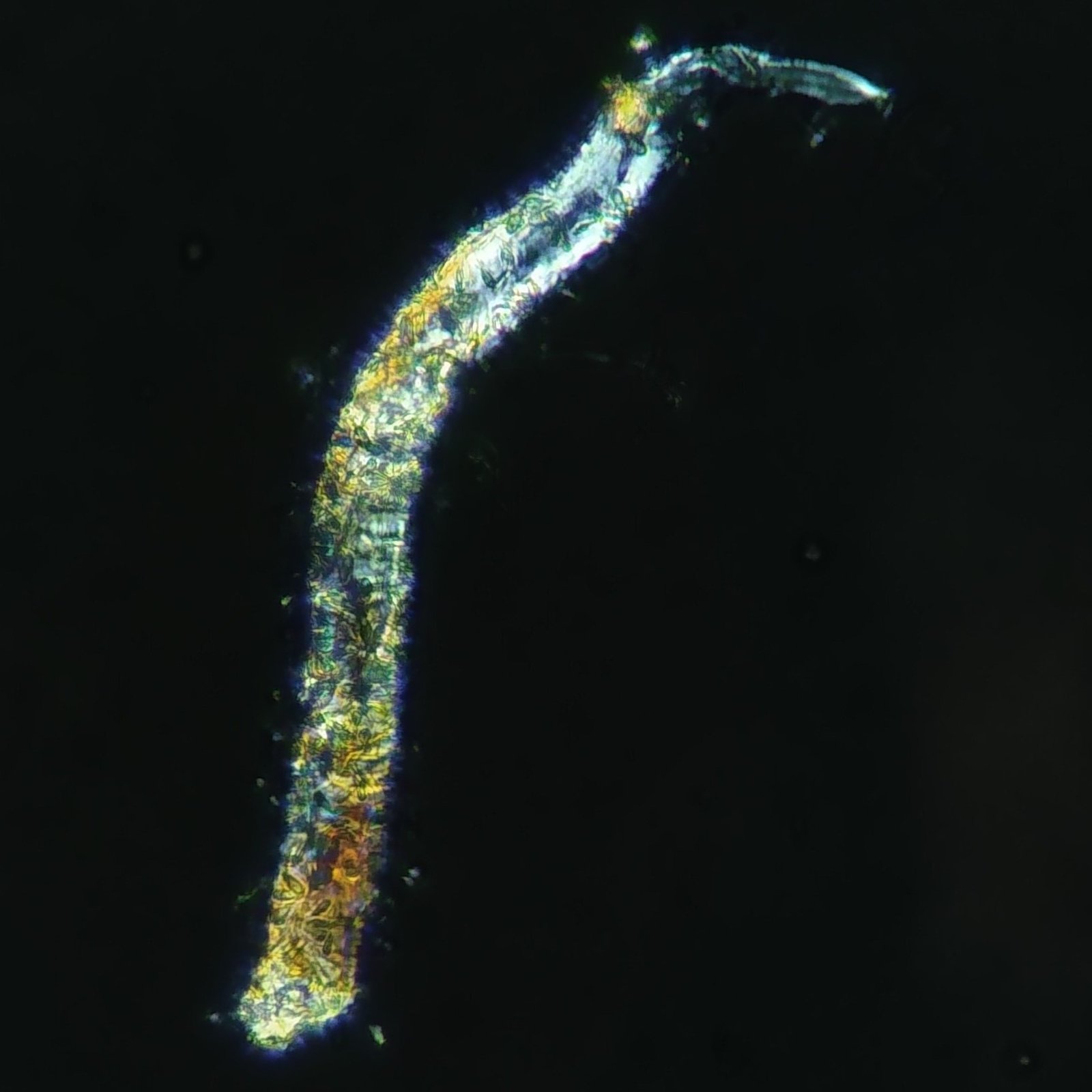 Urinary fiber, polarized