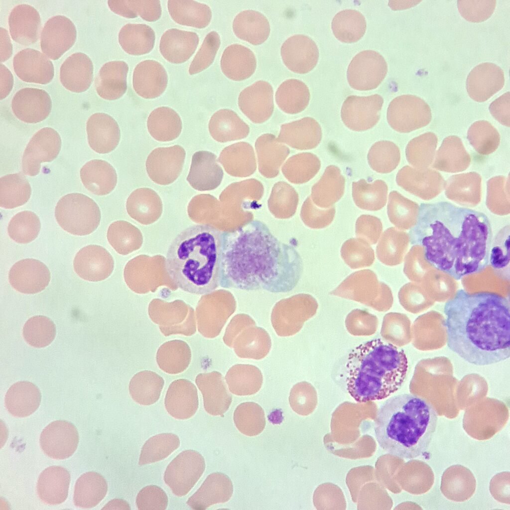 Giant Platelet