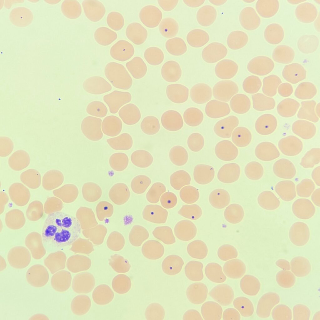 Howell-Jolly Bodies, Red blood cell inclusions