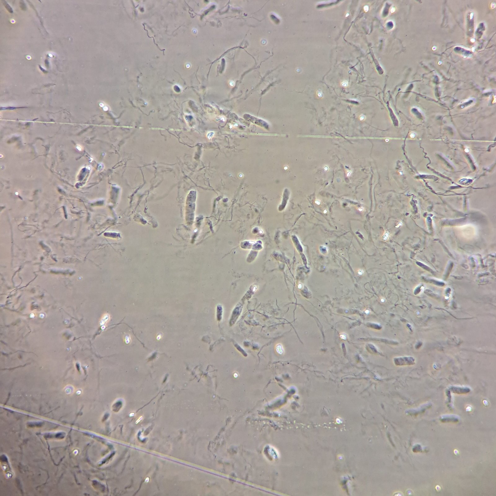 Hyaline Casts in Urine Sediment Under Phase Contrast
