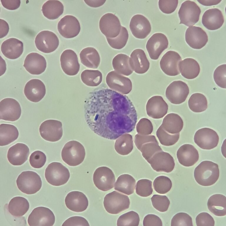 RBC Morphology Based on Shape
