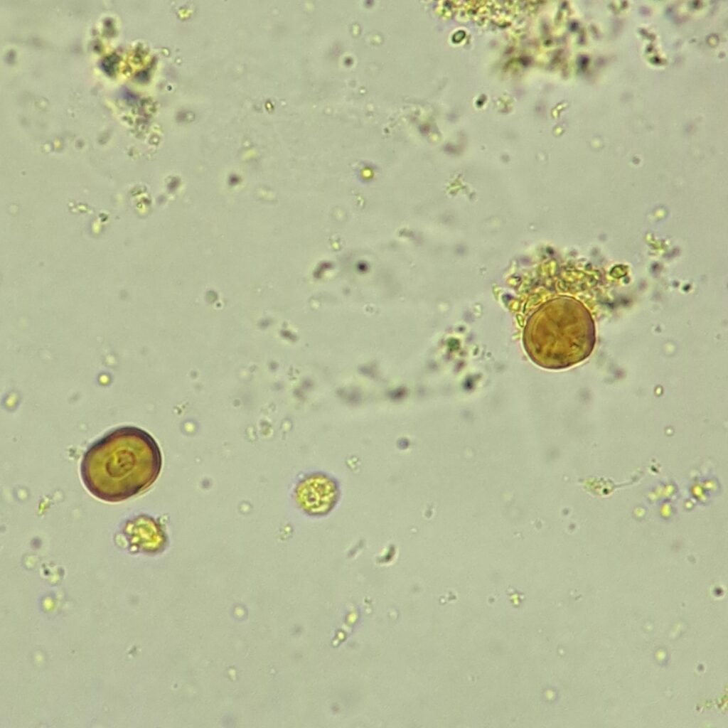Leucine Crystals