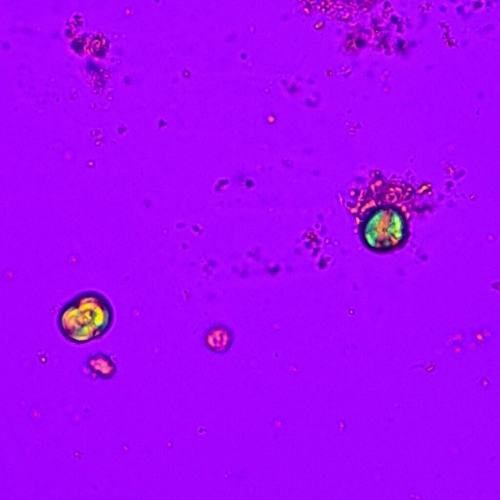 Leucine Crystals (Polarized) Pseudo-Maltese cross