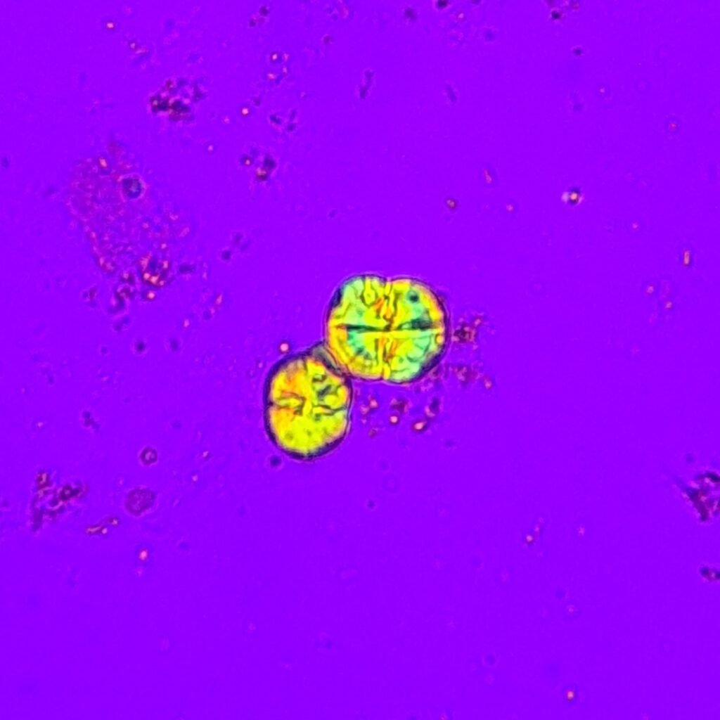 Leucine Crystals (Polarized) Pseudo-Maltese cross
