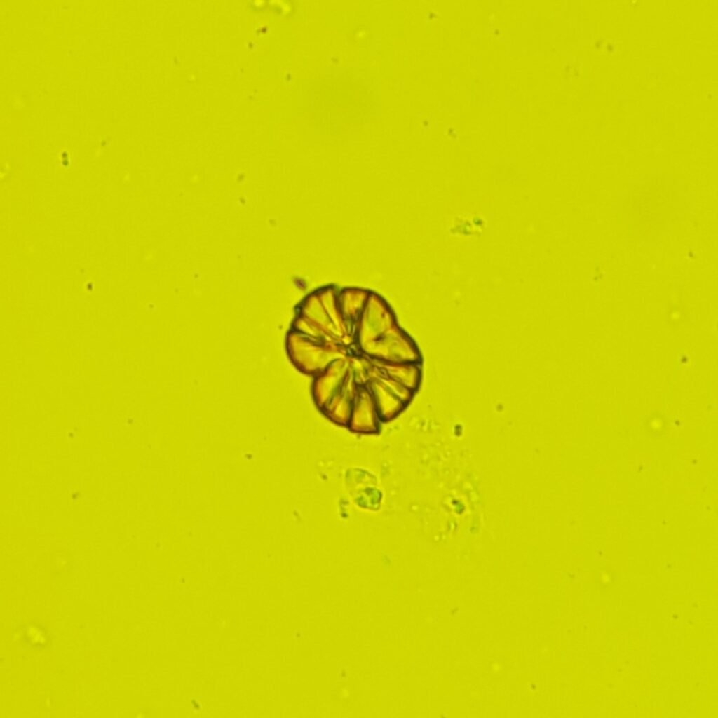 Leucine Crystals